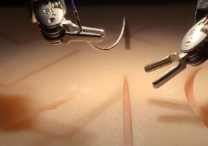 Robot that watched surgery videos performs tasks with skill of human doctor